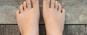 Girl with White Toe Nails Painted
