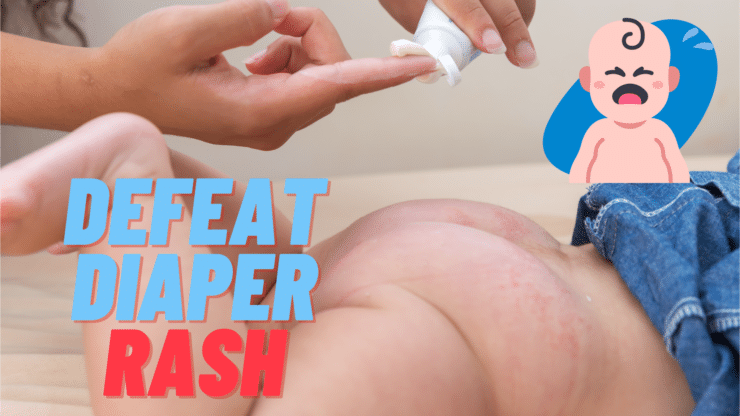 Baby with Diaper Rash